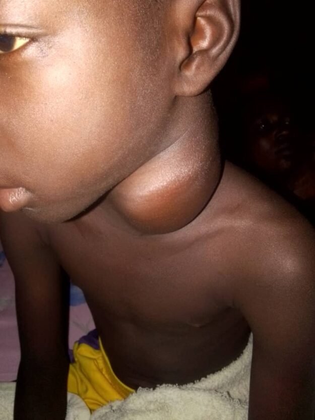 cropped-WhatsApp-Image-2026-05-15-at-22.44.07-1.jpeg 🚨 URGENCE POUR UN ENFANT DE 9 ANS 🚨 – Image 1